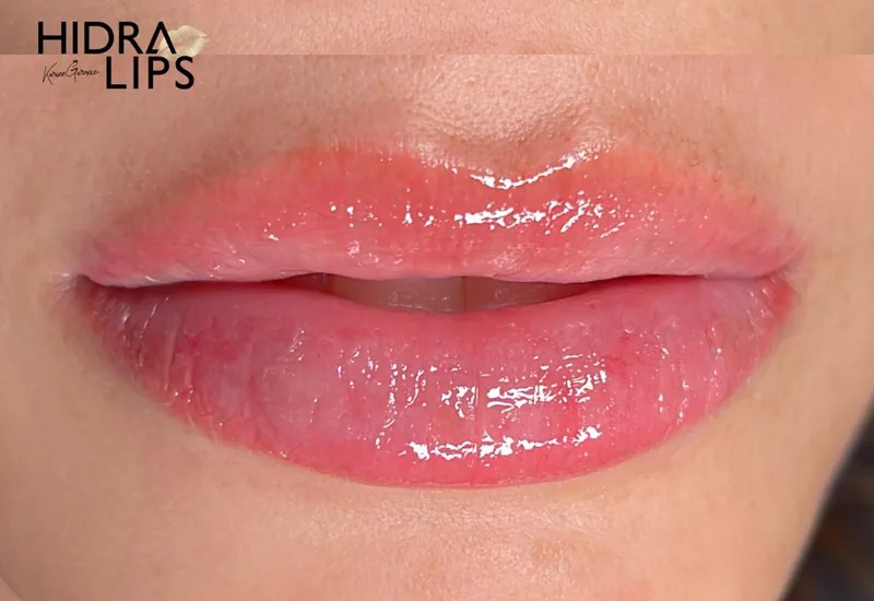 Hidra Lips com efeito gloss e cor natural em Caraguatatuba
